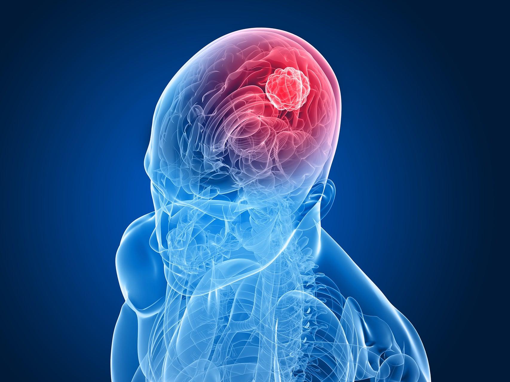 the potential of cannabis in brain cancer treatment has been recognized by fda